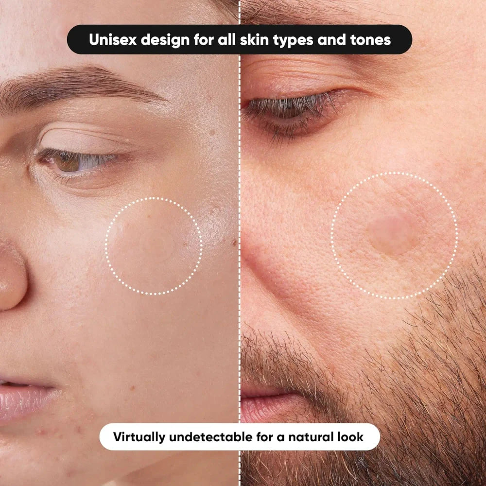 Hydrocolloid Acne Patches
