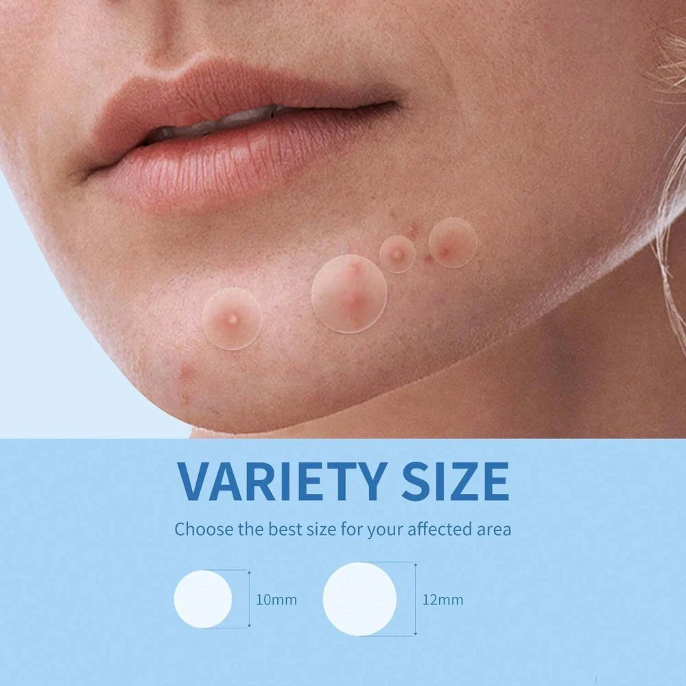 Hydrocolloid Acne Patches